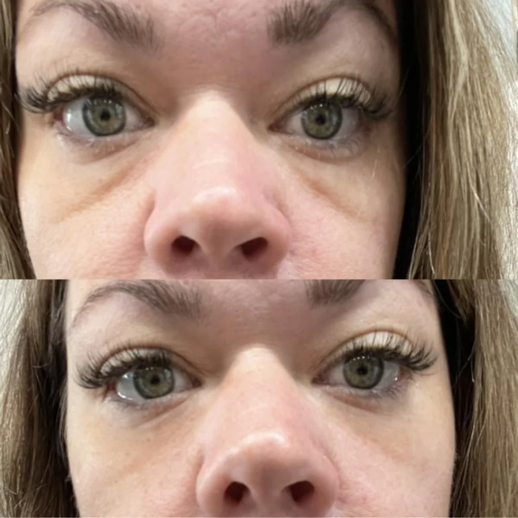 Antes e Depois 3